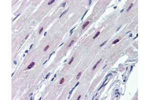 SOX4 antibody was used for immunohistochemistry at a concentration of 4-8 ug/ml. (SOX4 抗体  (N-Term))