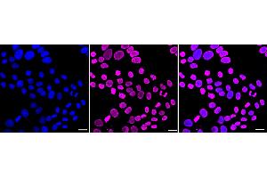 Immunocytochemical staining of HepG2 cells with Histone H4 (acetyl K5) antibody (ABIN7798979), 1:1,000). (Recombinant Histone H4 抗体  (H4K5ac))