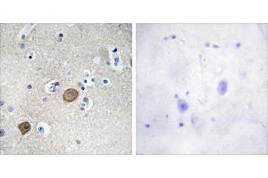 Peptide - +Immunohistochemistry analysis of paraffin-embedded human brain tissue using Catenin-α1 antibody. (CTNNA1 抗体  (Internal Region))