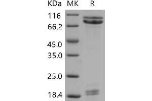 Western Blotting (WB) image for Cadherin 1, Type 1, E-Cadherin (Epithelial) (CDH1) (Active) protein (His tag) (ABIN7320196)