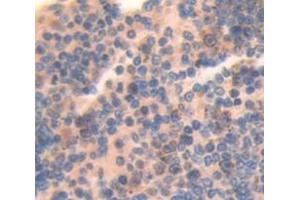 Figure. (CRLF1 抗体  (AA 138-422))