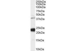 Western Blotting (WB) image for anti-GIPC PDZ Domain Containing Family, Member 1 (GIPC1) (C-Term) antibody (ABIN2465223) (GIPC1 抗体  (C-Term))