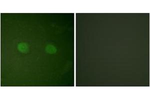 Immunofluorescence analysis of HeLa cells, using PPAR-alpha (Ab-21) Antibody. (PPARA 抗体  (AA 6-55))