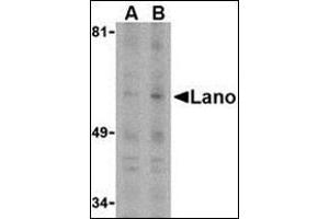 Western blot analysis of Lano in PC-3 whole cell lysate with this product at (A) 1 or (B) 2 μg /ml. (LRRC1 抗体  (C-Term))