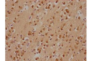 IHC image of ABIN7146598 diluted at 1:200 and staining in paraffin-embedded human brain tissue performed on a Leica BondTM system.