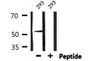 Western Blotting (WB) image for anti-Activating Transcription Factor 7 (ATF7) (N-Term) antibody (ABIN6256915)