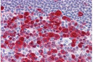 Human Tonsil: Formalin-Fixed, Paraffin-Embedded (FFPE) (Deoxyuridine Triphosphatase (DUT) (AA 68-164) 抗体)