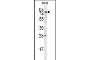 Western Blotting (WB) image for anti-Iduronidase, alpha-L- (IDUA) (AA 236-264) antibody (ABIN651536)