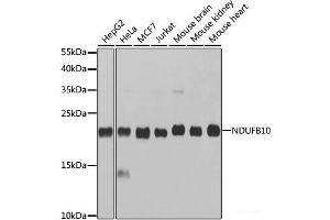 Western blot analysis of extracts of various cell lines using NDUFB10 Polyclonal Antibody at dilution of 1:1000. (NDUFB10 抗体)
