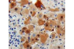 IHC-P analysis of Liver tissue, with DAB staining. (TTR 抗体  (AA 21-147))
