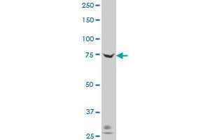 ADAM20 polyclonal antibody (A01), Lot # 060613JCS1 Western Blot analysis of ADAM20 expression in Hela S3 NE . (ADAM20 抗体  (AA 268-358))