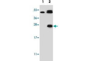 Western blot analysis of KLK6 (arrow) using KLK6 polyclonal antibody . (Kallikrein 6 抗体  (Internal Region))