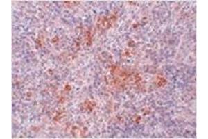 Immunohistochemistry of AGTR1 in mouse kidney tissue with AGTR1 antibody at 2. (Angiotensin II Type-1 Receptor 抗体  (Center))