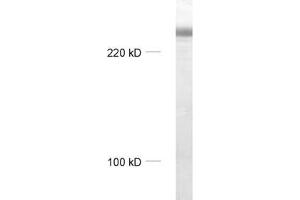 dilution: 1 : 1000, sample: rat brain homogenate (MAP2 抗体  (AA 2-309))