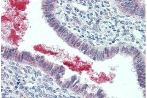 Human Uterus (formalin-fixed, paraffin-embedded) stained with GRN antibody ABIN396952 at 5 ug/ml followed by biotinylated goat anti-rabbit IgG secondary antibody ABIN481713, alkaline phosphatase-streptavidin and chromogen. (Granulin 抗体  (C-Term))