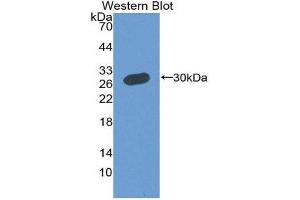 Western Blotting (WB) image for anti-Membrane Protein, Palmitoylated 5 (MAGUK P55 Subfamily Member 5) (MPP5) (AA 455-675) antibody (ABIN2119305) (MPP5 抗体  (AA 455-675))