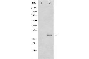 Western blot analysis of SNAI1 expression in HT29 whole cell lysates,The lane on the left is treated with the antigen-specific peptide. (SNAIL 抗体  (C-Term))