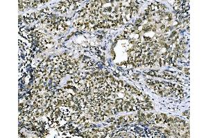 IHC analysis of CSNK2B using anti-CSNK2B antibody (ABIN7599092). (CSNK2B 抗体  (AA 1-215))