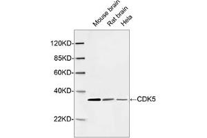 Western blot analysis of cell and tissue lysates using 1 µg/mL Rabbit Anti-CDK5 Polyclonal Antibody (ABIN398921) The signal was developed with IRDyeTM 800 Conjugated Goat Anti-Rabbit IgG.