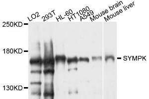 Western blot analysis of extract of various cells, using SYMPK antibody. (Symplekin 抗体)