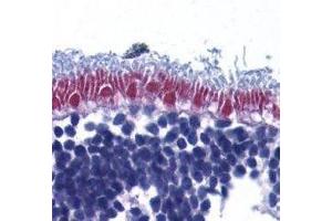 Immunohistochemistry (IHC) image for anti-Apoptosis-Inducing Factor, Mitochondrion-Associated, 1 (AIFM1) (AA 517-531) antibody (ABIN2477305) (AIF 抗体  (AA 517-531))