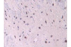IHC-P analysis of Rat Spinal Cord Tissue, with DAB staining. (Endoglin 抗体  (AA 26-136))