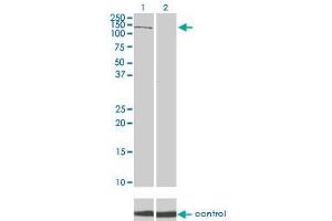 Western blot analysis of PIK3R4 over-expressed 293 cell line, cotransfected with PIK3R4 Validated Chimera RNAi (Lane 2) or non-transfected control (Lane 1). (PIK3R4 抗体  (AA 1259-1358))