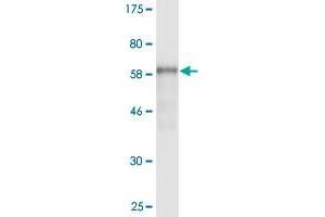 Western Blot detection against Immunogen (62. (AMBP 抗体  (AA 19-352))