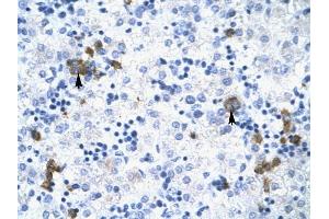 TRIM17 antibody was used for immunohistochemistry at a concentration of 4-8 ug/ml to stain Liver cells (arrows) in Human Liver. (TRIM17 / RNF16 抗体  (Middle Region))