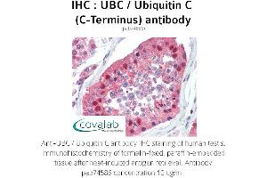 Image no. 2 for anti-Ubiquitin C (UBC) (C-Term) antibody (ABIN2852400) (UBC 抗体  (C-Term))