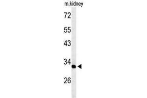 Western blot analysis of TMUB2 Antibody (Center) in mouse kidney tissue lysates (35 µg/lane). (TMUB2 抗体  (Middle Region))