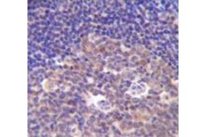Immunohistochemistry analysis in human tonsil tissue (Formalin-fixed, Paraffin-embedded) using PIK3R5  Antibody  (C-term), followed by peroxidase conjugated secondary antibody and DAB staining. (PIK3R5 抗体  (C-Term))