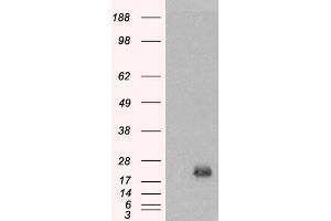 Western Blotting (WB) image for anti-Brain and Acute Leukemia, Cytoplasmic (BAALC) antibody (ABIN5858423) (BAALC 抗体)