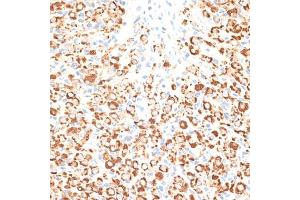 Immunohistochemistry of paraffin-embedded rat ovary using KLHL9 antibody (ABIN6132083, ABIN6142940, ABIN6142941 and ABIN6214299) at dilution of 1:100 (40x lens). (KLHL9 抗体  (AA 1-100))