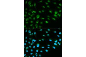 Immunofluorescence analysis of HeLa cell using MCM7 antibody. (MCM7 抗体  (AA 360-719))