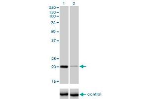 Western blot analysis of CETN3 over-expressed 293 cell line, cotransfected with CETN3 Validated Chimera RNAi (Lane 2) or non-transfected control (Lane 1). (CETN3 抗体  (AA 1-100))