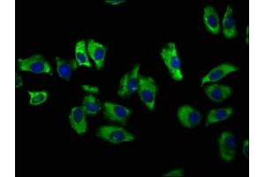 Immunofluorescence (IF) image for anti-Solute Carrier Family 12 (Potassium-Chloride Transporter) Member 2 (SLC12A2) (AA 110-282) antibody (ABIN7170071)