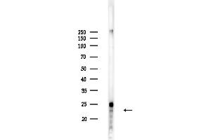 anti-Nuclear Import 7 Homolog (NIP7) (C-Term) antibody