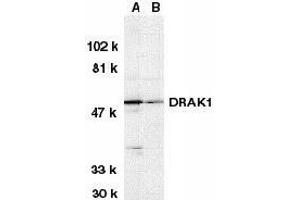 Western blot analysis of DRAK1 in (A) MOLT4 and (B) A431 whole cell lysates with DRAK1 antibody at 1μg/ml. (STK17A 抗体  (AA 5-19))