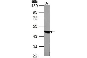 Western Blotting (WB) image for anti-Fumarate Hydratase (FH) antibody (ABIN2856710)