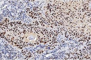 IHC analysis of FEN1 using anti-FEN1 antibody (ABIN7601618).
