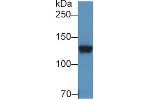 Detection of DPP6 in Rat Cerebrum lysate using Polyclonal Antibody to Dipeptidyl Peptidase 6 (DPP6) (DPP6 抗体  (AA 667-865))