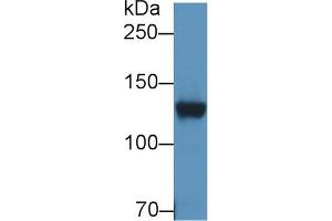 Detection of DPP6 in Rat Cerebrum lysate using Polyclonal Antibody to Dipeptidyl Peptidase 6 (DPP6)