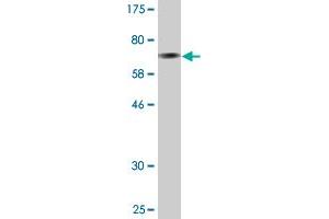 Western Blot detection against Immunogen (74. (GDI1 抗体  (AA 1-447))