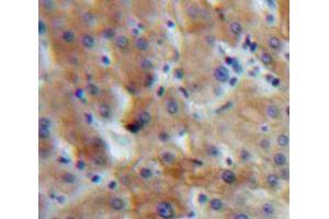 Used in DAB staining on fromalin fixed paraffin-embedded Liver tissue (IGF1 抗体  (AA 49-153))