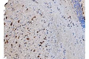 IHC analysis of GABARAP using anti-GABARAP antibody (ABIN7603159). (GABARAP 抗体  (N-Term))