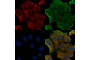 ABIN6258012 and ABIN6275850 staining Hela cells by IF/ICC. (CDC42BPA 抗体  (Internal Region))