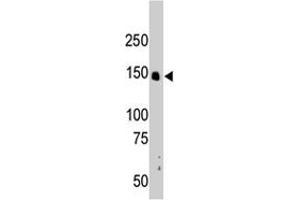 The CRKRS polyclonal antibody  is used in Western blot to detect CRKRS in mouse liver tissue lysate. (CDK12 抗体  (N-Term))