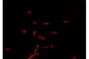 ABIN6275090 staining Hela by IF/ICC. (PJA2 抗体)