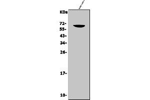 Western blot analysis of CD16/Fcgr3 using anti-CD16/Fcgr3 antibody (ABIN7602814).